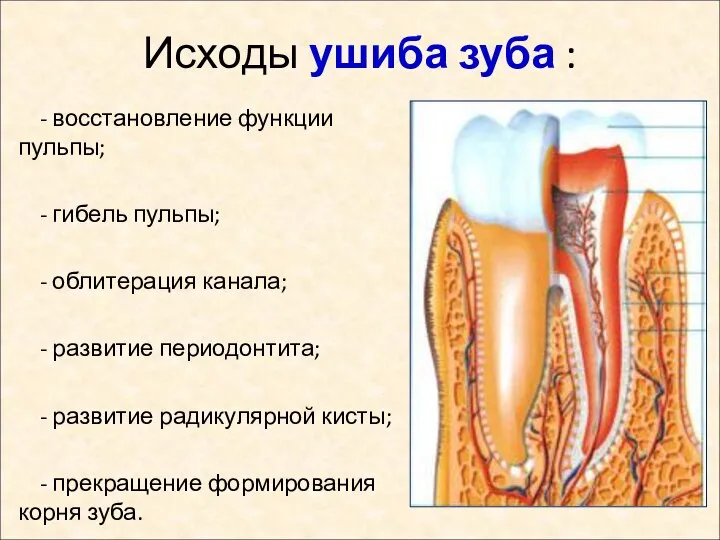 Исходы ушиба зуба : - восстановление функции пульпы; - гибель пульпы; -