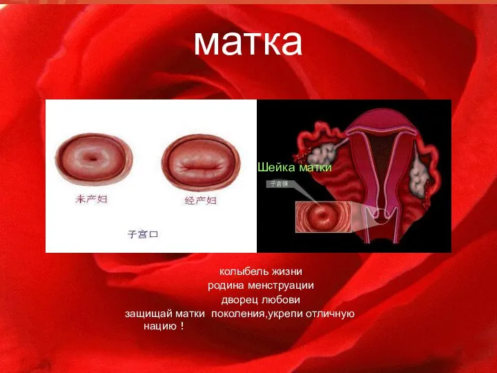 матка колыбель жизни родина менструации дворец любови защищай матки поколения,укрепи отличную нацию！