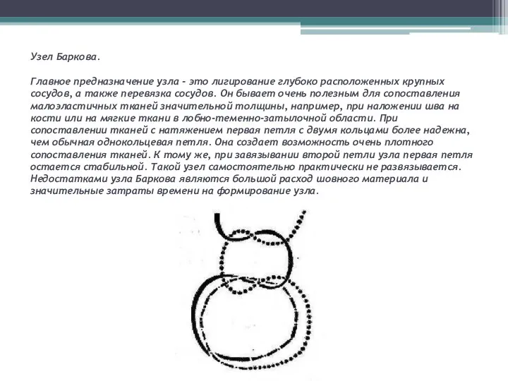 Узел Баркова. Главное предназначение узла - это лигирование глубоко расположенных крупных сосудов,