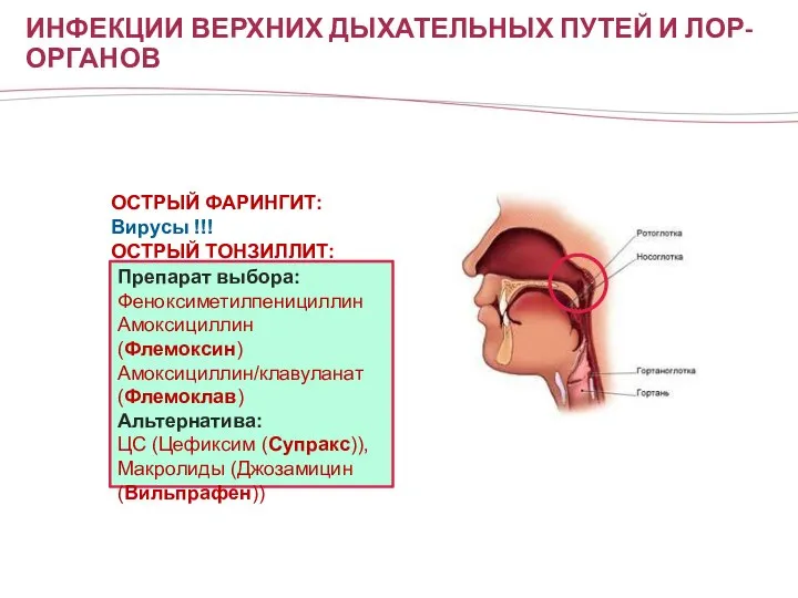 ИНФЕКЦИИ ВЕРХНИХ ДЫХАТЕЛЬНЫХ ПУТЕЙ И ЛОР-ОРГАНОВ ОСТРЫЙ ФАРИНГИТ: Вирусы !!! ОСТРЫЙ ТОНЗИЛЛИТ: