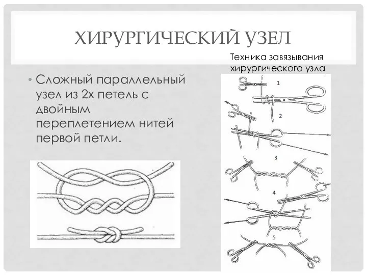 ХИРУРГИЧЕСКИЙ УЗЕЛ Сложный параллельный узел из 2х петель с двойным переплетением нитей