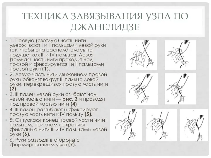 ТЕХНИКА ЗАВЯЗЫВАНИЯ УЗЛА ПО ДЖАНЕЛИДЗЕ 1. Правую (светлую) часть нити удерживают I