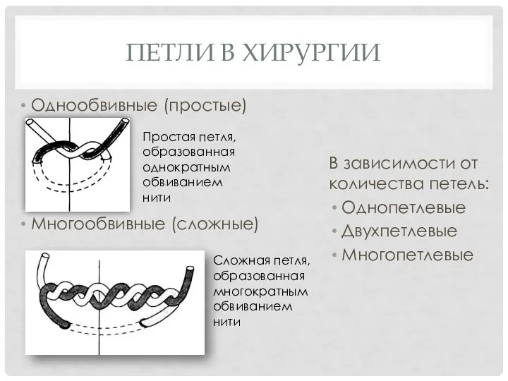 ПЕТЛИ В ХИРУРГИИ В зависимости от количества петель: Однопетлевые Двухпетлевые Многопетлевые Простая