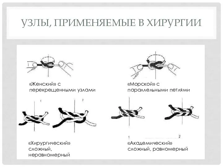 УЗЛЫ, ПРИМЕНЯЕМЫЕ В ХИРУРГИИ «Женский» с перекрещенными узлами «Морской» с параллельными петлями