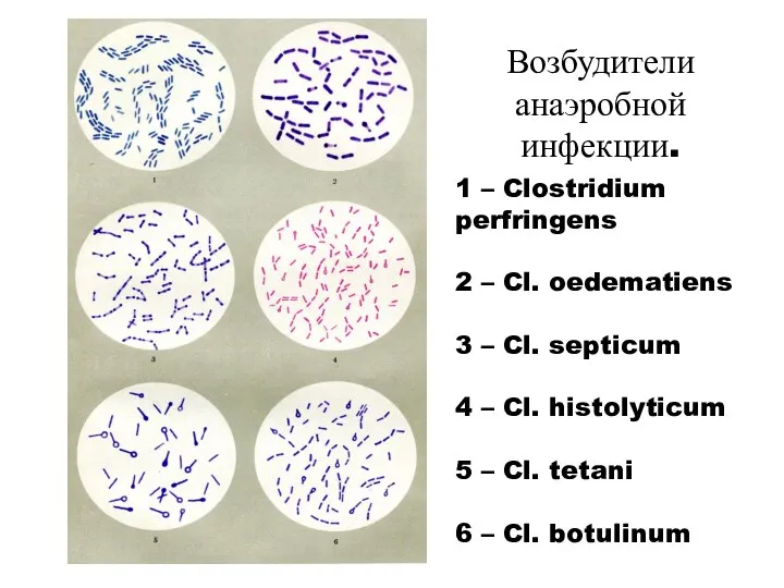 Возбудители анаэробной инфекции. 1 – Clostridium perfringens 2 – Cl. oedematiens 3