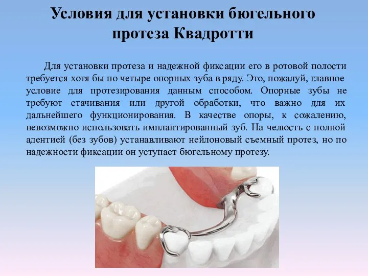 Условия для установки бюгельного протеза Квадротти Для установки протеза и надежной фиксации