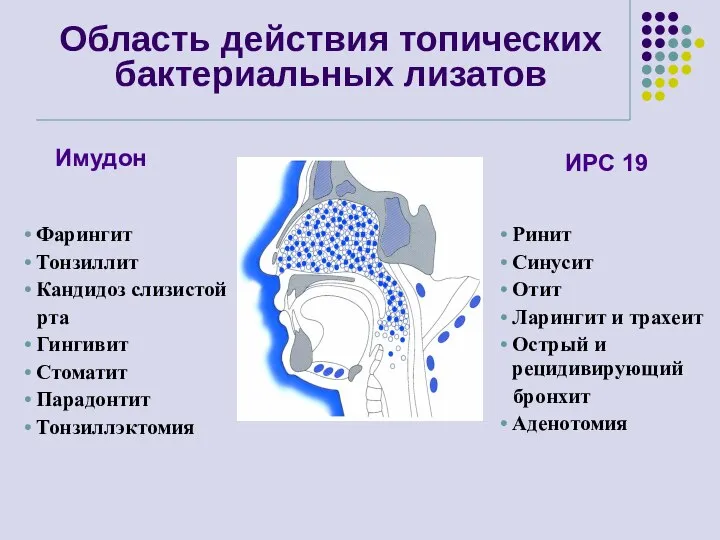 Ринит Синусит Отит Ларингит и трахеит Острый и рецидивирующий бронхит Аденотомия Область