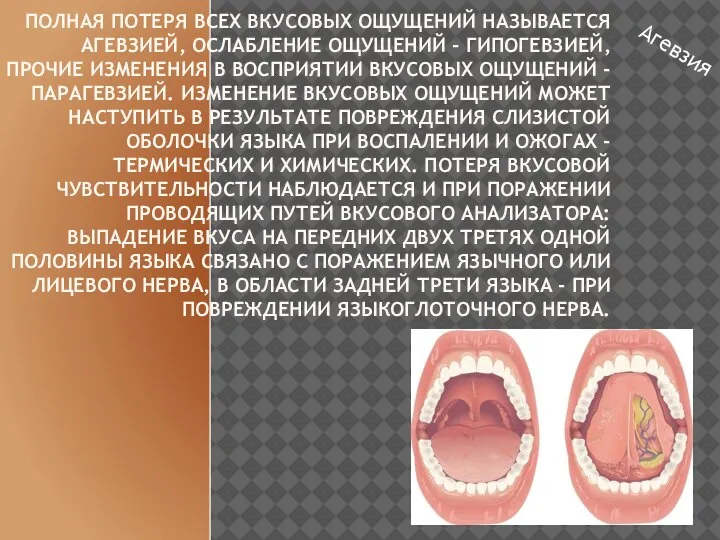 ПОЛНАЯ ПОТЕРЯ ВСЕХ ВКУСОВЫХ ОЩУЩЕНИЙ НАЗЫВАЕТСЯ АГЕВЗИЕЙ, ОСЛАБЛЕНИЕ ОЩУЩЕНИЙ - ГИПОГЕВЗИЕЙ, ПРОЧИЕ