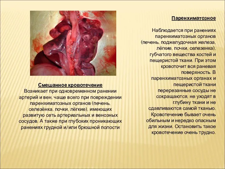 Паренхиматозное Наблюдается при ранениях паренхиматозных органов (печень, поджелудочная железа, лёгкие, почки, селезенка),