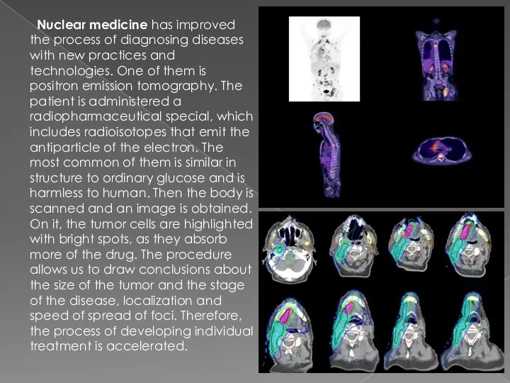 Nuclear medicine has improved the process of diagnosing diseases with new practices