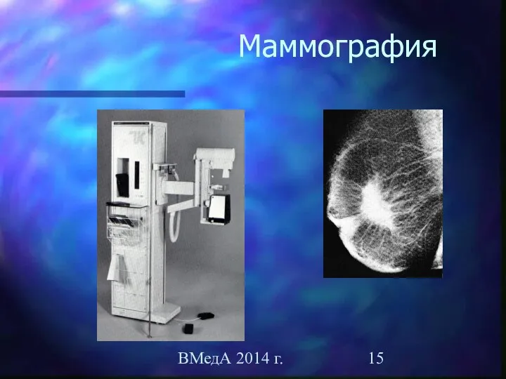 ВМедА 2014 г. Маммография