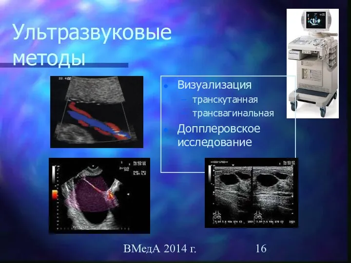 ВМедА 2014 г. Ультразвуковые методы Визуализация транскутанная трансвагинальная Допплеровское исследование