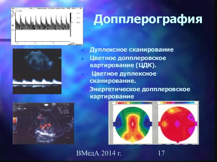 ВМедА 2014 г. Допплерография Дуплексное сканирование Цветное допплеровское картирование (ЦДК). Цветное дуплексное сканирование. Энергетическое допплеровское картирование