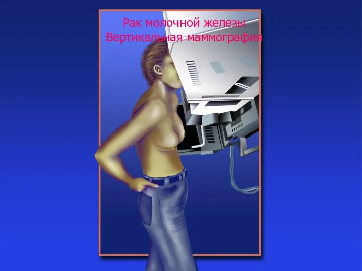 ВМедА 2014 г. Рак молочной железы Вертикальная маммография
