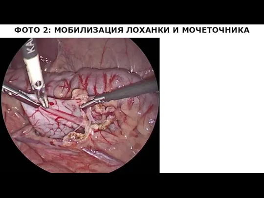 ФОТО 2: МОБИЛИЗАЦИЯ ЛОХАНКИ И МОЧЕТОЧНИКА