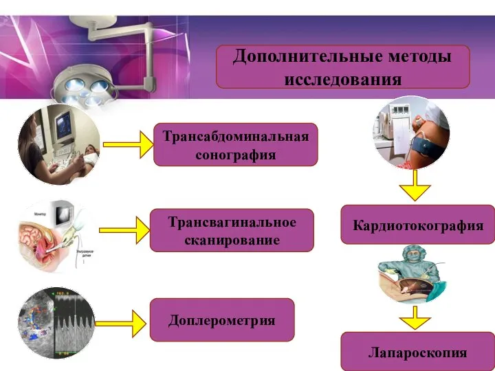 Дополнительные методы исследования Трансабдоминальная сонография Трансвагинальное сканирование Доплерометрия Кардиотокография Лапароскопия