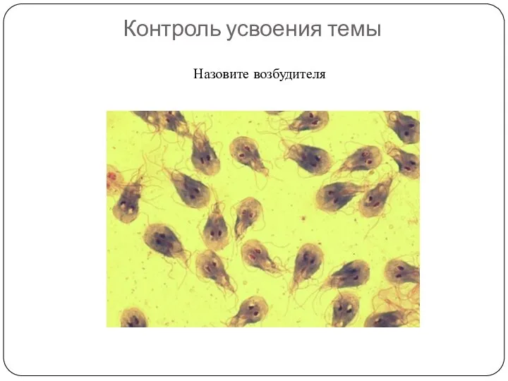 Контроль усвоения темы Назовите возбудителя