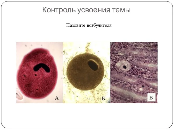 Контроль усвоения темы Назовите возбудителя