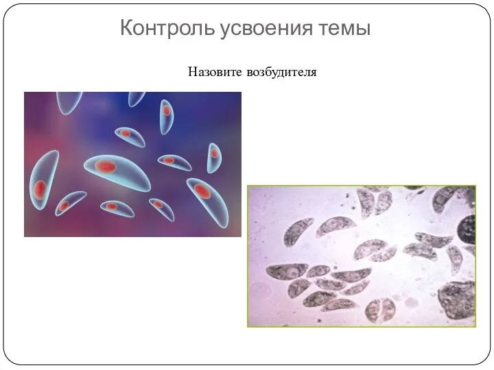 Контроль усвоения темы Назовите возбудителя