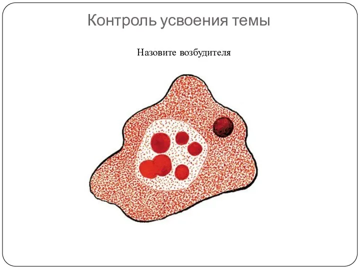 Контроль усвоения темы Назовите возбудителя