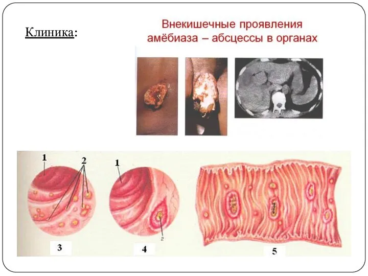 Клиника: