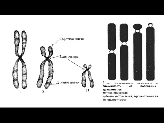 Типы метафазных хромосом в зависимости от положения центромеры: метацентрическая, субметацентрическая, акроцентрическая, телоцентрическая