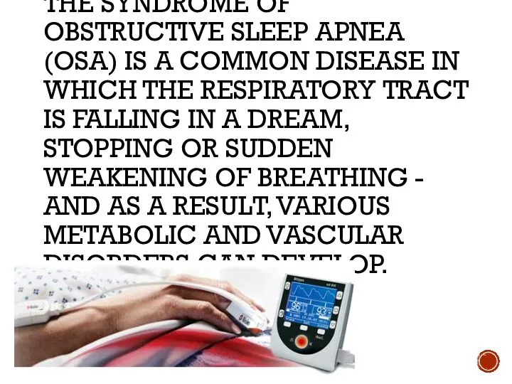 THE SYNDROME OF OBSTRUCTIVE SLEEP APNEA (OSA) IS A COMMON DISEASE IN