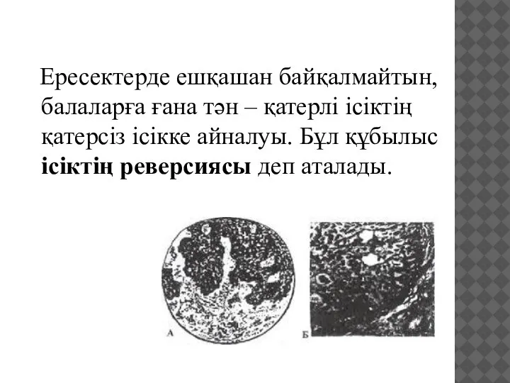 Ересектерде ешқашан байқалмайтын, балаларға ғана тән – қатерлі ісіктің қатерсіз ісікке айналуы.