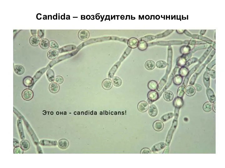 Candida – возбудитель молочницы