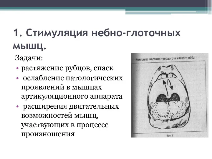 1. Стимуляция небно-глоточных мышц. Задачи: растяжение рубцов, спаек ослабление патологических проявлений в