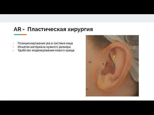 AR - Пластическая хирургия Позиционирование уха в системе лица Изъятие материала нужного
