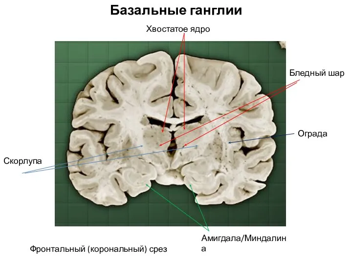 Фронтальный (корональный) срез Бледный шар Хвостатое ядро Скорлупа Амигдала/Миндалина Ограда Базальные ганглии