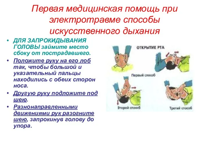 Первая медицинская помощь при электротравме способы искусственного дыхания ДЛЯ ЗАПРОКИДЫВАНИЯ ГОЛОВЫ займите