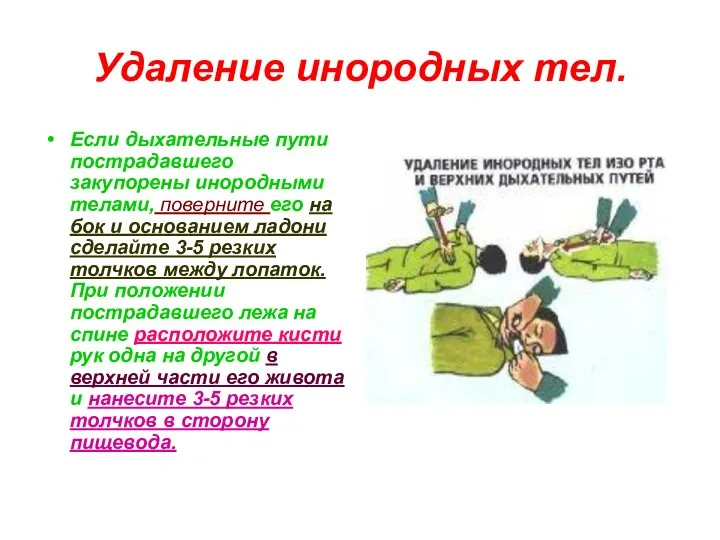 Удаление инородных тел. Если дыхательные пути пострадавшего закупорены инородными телами, поверните его