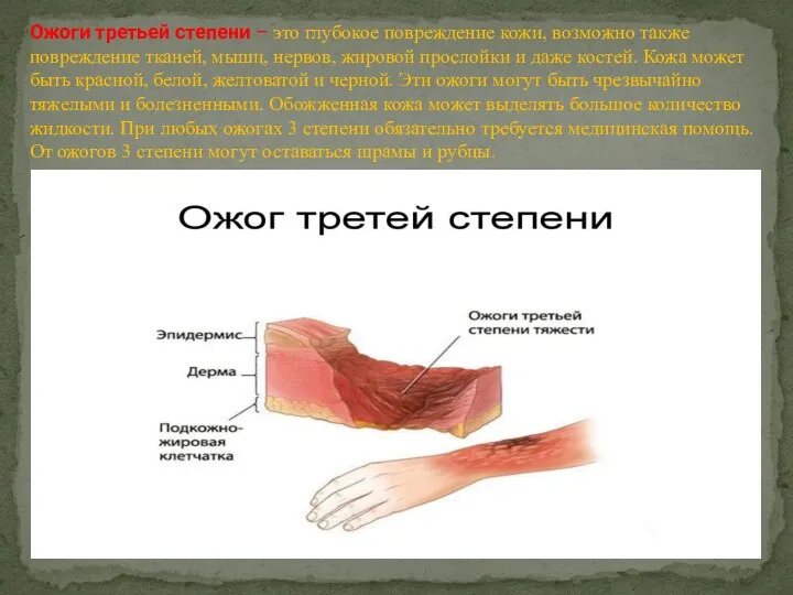 Ожоги третьей степени – это глубокое повреждение кожи, возможно также повреждение тканей,