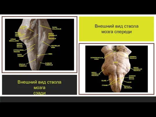 Внешний вид ствола мозга сзади Внешний вид ствола мозга спереди