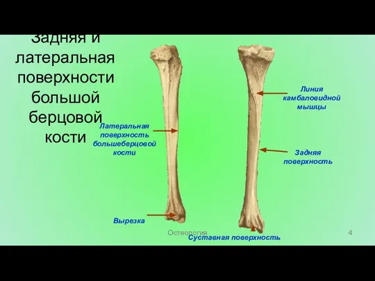 Суставная поверхность Линия камбаловидной мышцы Задняя поверхность Латеральная поверхность большеберцовой кости Вырезка