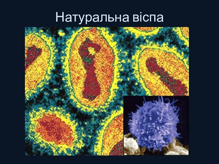 Натуральна віспа