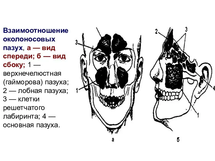 Взаимоотношение околоносовых пазух, а — вид спереди; б — вид сбоку; 1