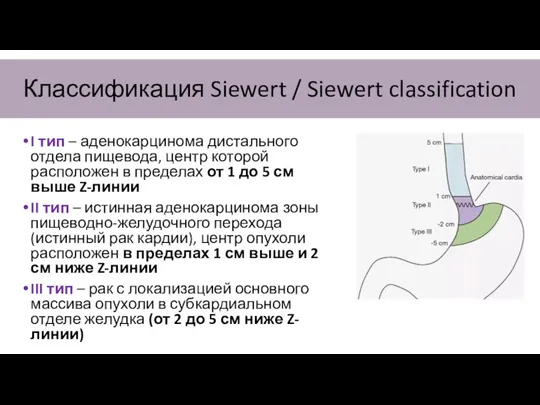 Классификация Siewert / Siewert classification I тип – аденокарцинома дистального отдела пищевода,