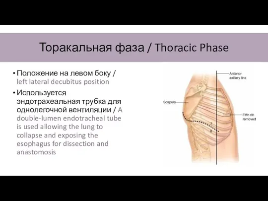 Торакальная фаза / Thoracic Phase Положение на левом боку / left lateral