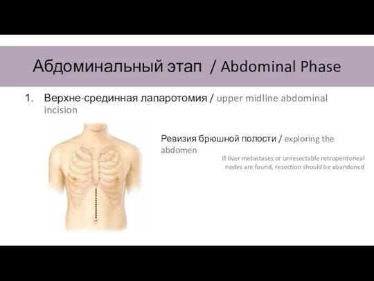 Абдоминальный этап / Abdominal Phase Верхне-срединная лапаротомия / upper midline abdominal incision