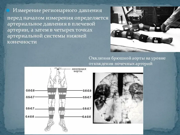 Измерение регионарного давления перед началом измерения определяется артериальное давления в плечевой артерии,