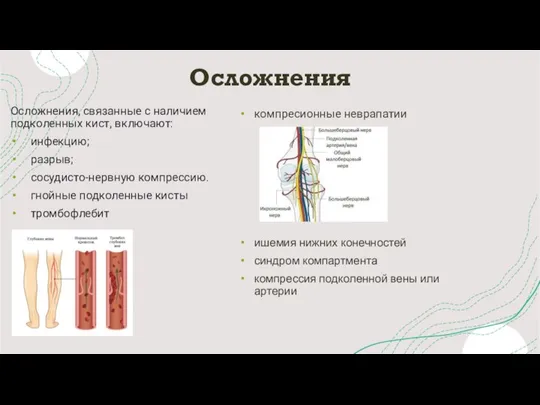 Осложнения Осложнения, связанные с наличием подколенных кист, включают: инфекцию; разрыв; сосудисто-нервную компрессию.