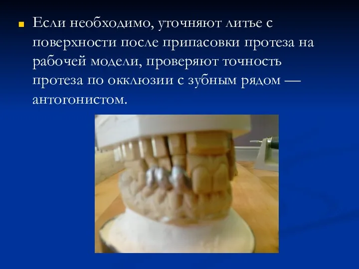 Если необходимо, уточняют литье с поверхности после припасовки протеза на рабочей модели,