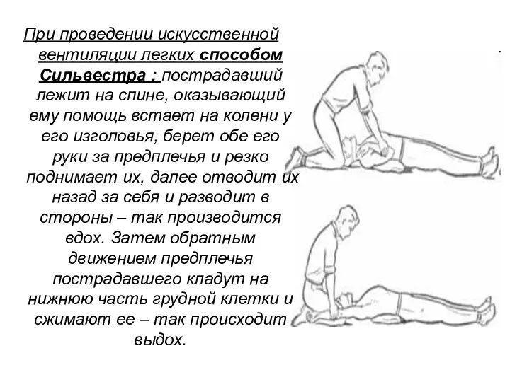 При проведении искусственной вентиляции легких способом Сильвестра : пострадавший лежит на спине,