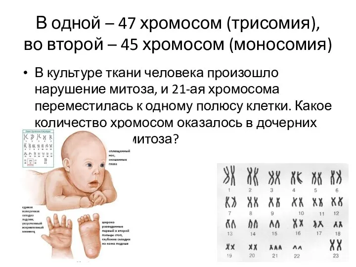 В одной – 47 хромосом (трисомия), во второй – 45 хромосом (моносомия)
