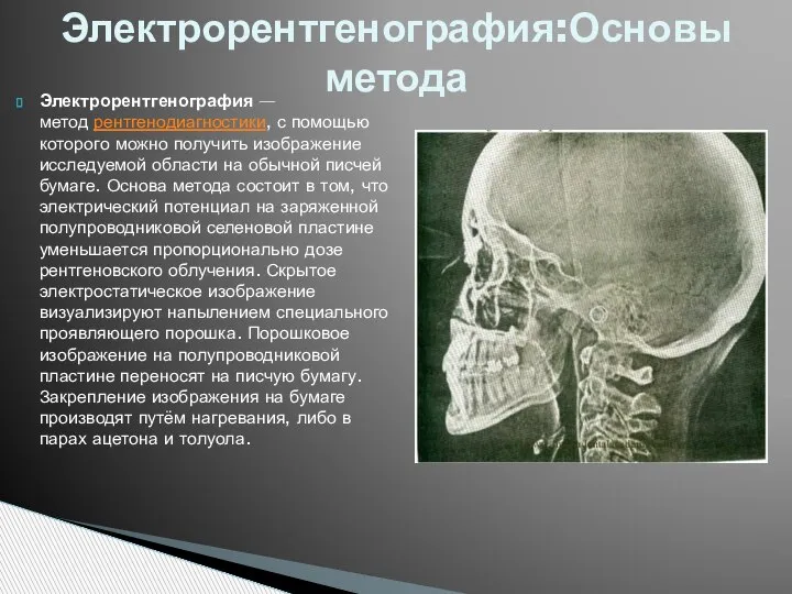 Электрорентгенография — метод рентгенодиагностики, с помощью которого можно получить изображение исследуемой области