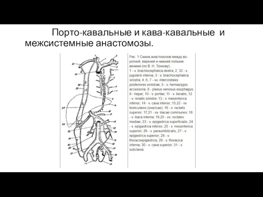 Порто-кавальные и кава-кавальные и межсистемные анастомозы.