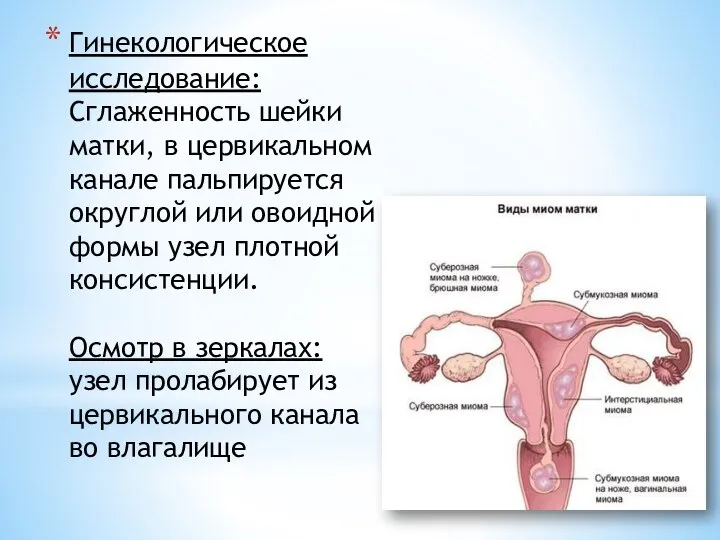 Гинекологическое исследование: Сглаженность шейки матки, в цервикальном канале пальпируется округлой или овоидной